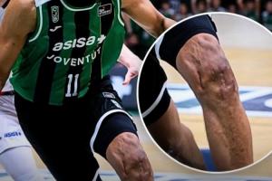 贾巴里·帕克膝盖近照:沟壑纵横 千疮百孔!曾遭两次ACL撕裂