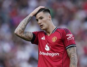 欧文:舍什科不是曼联的长期答案,虽然现在表现不错但还是不可靠